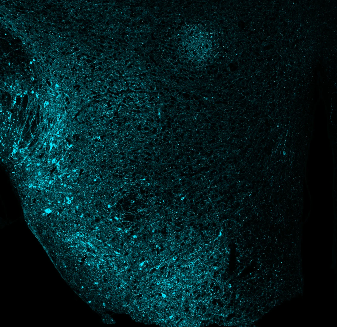 MC1-positive tau pathology in the ipsilateral hypothalamus of an AAV-Tau mouse.